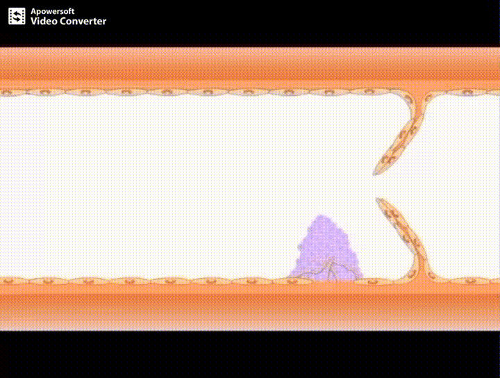 早读gif高清动图带你揭秘血栓形成全过程