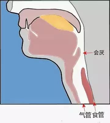 男子喉咙痛不当回事，几小时后直接被推进手术室！这种“嗓子疼”要当心！