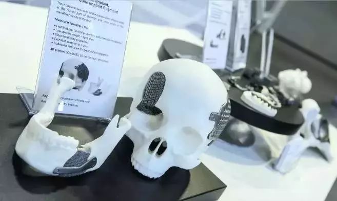 近20种获FDA审批的金属3D打印植入物大盘点