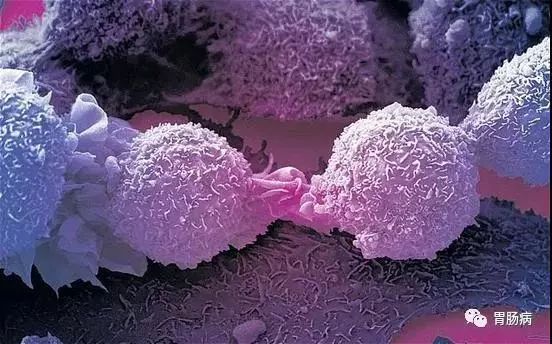 癌细胞的自述：我是可以被预防和治愈的！