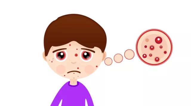 儿童寻麻疹，是什么原因导致的不吃药呢？