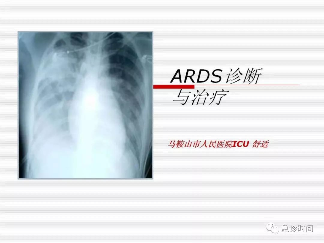 ARDS诊断与治疗