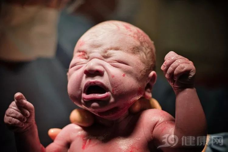 每年90万「缺陷婴儿」的生死抉择