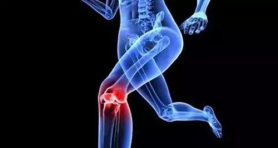 保膝治疗，为膝关节炎患者增加了一种选择