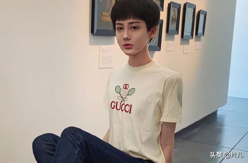 刘梓晨确诊新冠，曾因“蛇精脸”走红，粉丝贴心留言安慰