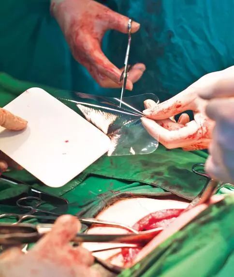 一起走进手术室，剖宫产的生产流程是怎么样的？
