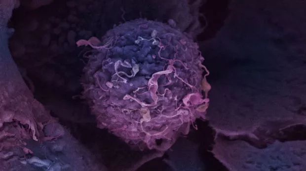 HER2传奇：死磕二十年，他们终于改变了乳腺癌治疗的历史