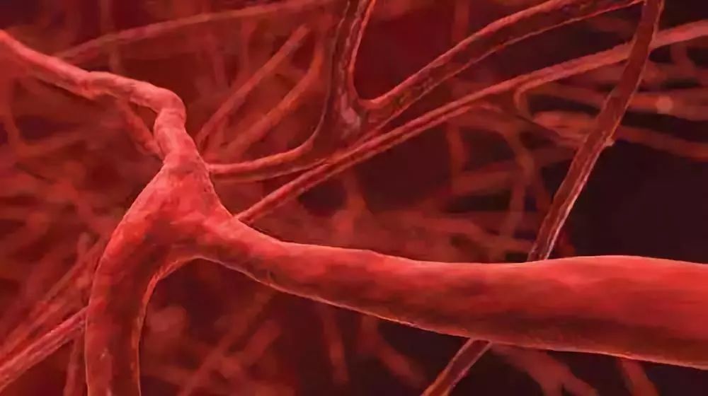 张大春健康观念：血管瘀堵的四个信号，你有吗？