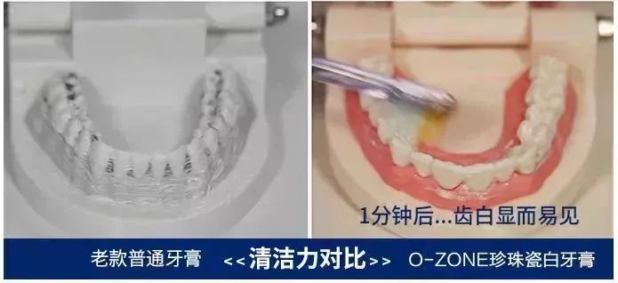 两分钟老黄牙开始变白！有了这支韩国国民美白牙膏，老污垢瞬间溶解，连多年的口臭都没了