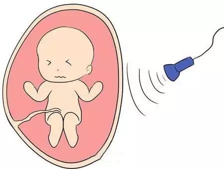 医生，..超声会伤害宝宝吗？能改成腹部超声吗？