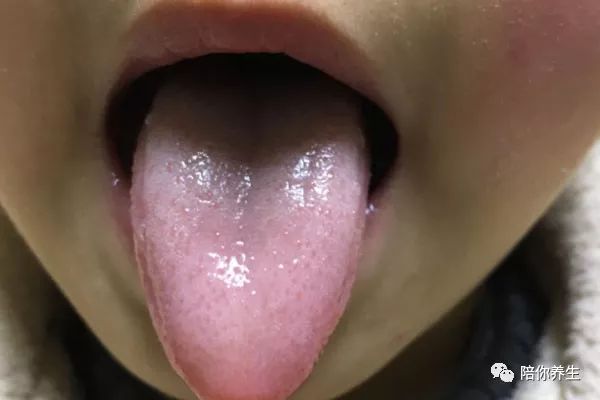 为什么生病时要看舌头 5种变化 可能是疾病信号