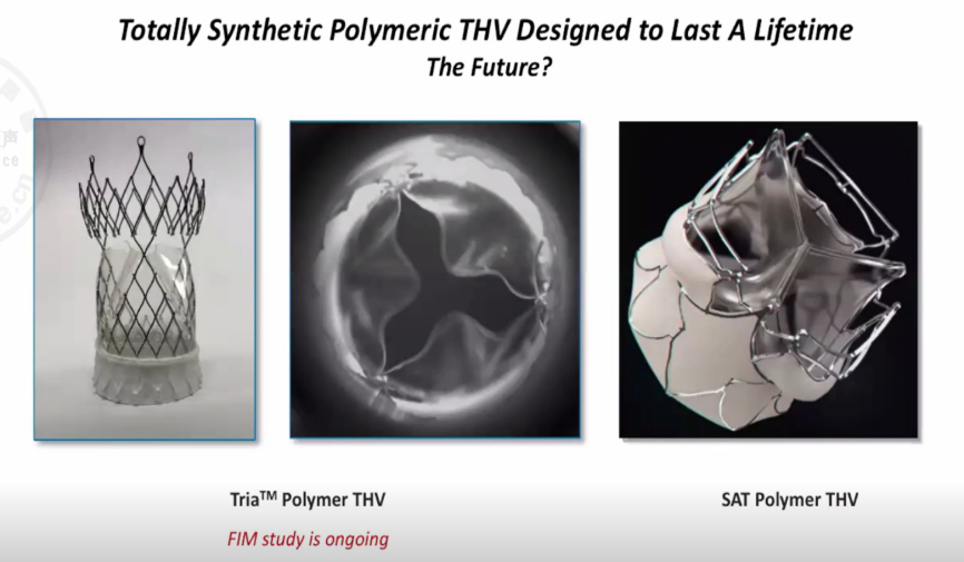 心讲座 | 长预期寿命患者最佳介入治疗：年轻、低危和/或二叶瓣患者